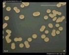 streptococcus equi on tryptic soy agar